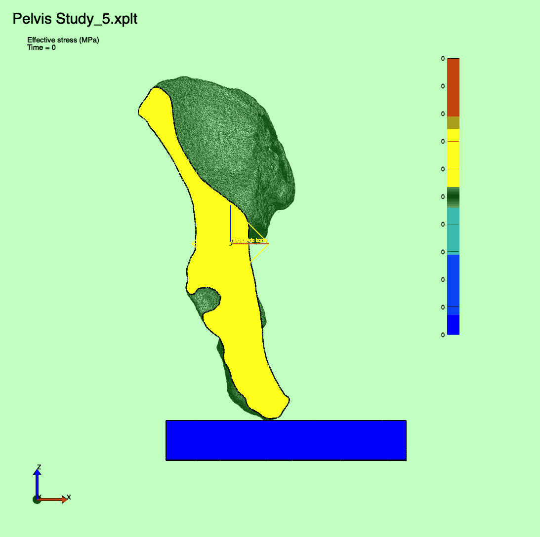 von Mises Stress distribution